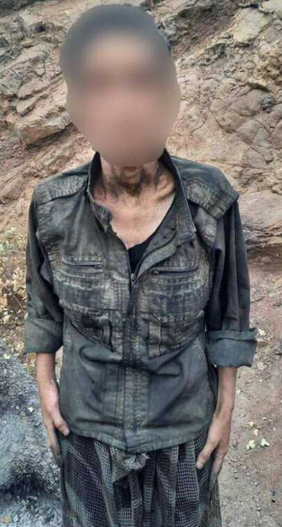PKK'lı teröristler sefalet içinde! Uzun süreli açlık sebebiyle bağırsakları delinmiş PKK'lı teröristler sefalet içinde! Uzun süreli açlık sebebiyle bağırsakları delinmiş