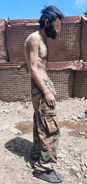 PKK'lı teröristler sefalet içinde! Uzun süreli açlık sebebiyle bağırsakları delinmiş PKK'lı teröristler sefalet içinde! Uzun süreli açlık sebebiyle bağırsakları delinmiş