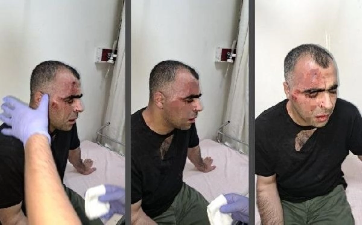Bitlis\'te gazeteci yumruklu saldırıya uğradı, polis memuru ve belediye çalışanı açığa alındı