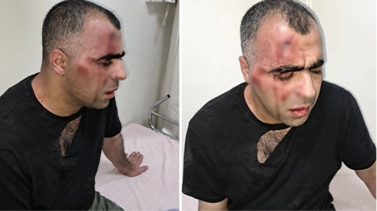 Gazeteci Sinan Aygül, Tatvan Belediyesi\'ndeki usulsüzlük iddialarını gündeme getirdiği için saldırıya uğradı