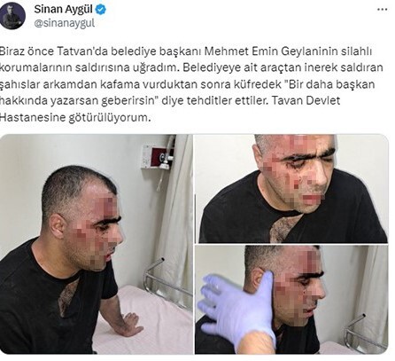 Gazeteci Sinan Aygül'ün darp edilmesi sonrası soruşturma açıldı: Polis memuru açığa alındı