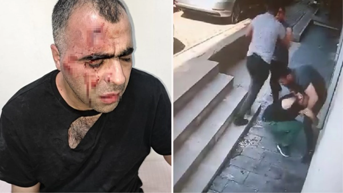 Gazeteci Sinan Aygül Tatvan\'da saldırıya uğradı
