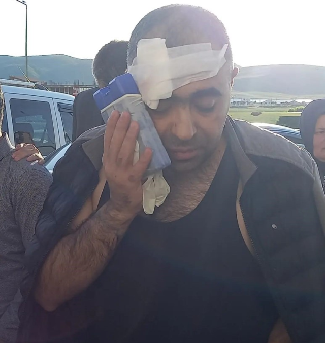 BİGACEM Başkanı Aygül'e saldırıya ilişkin 1'i polis 2 kişi gözaltına alındı