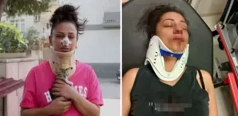 Pitbull, sokak kedilerine saldırdı: Komşusunun burnunu kırdı