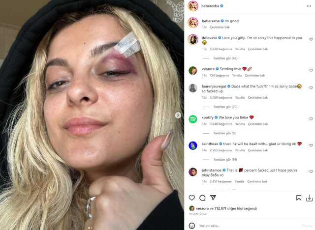 Bebe Rexha'ya konser sırasında telefon fırlatıldı Bebe Rexha'ya konser sırasında telefon fırlatıldı