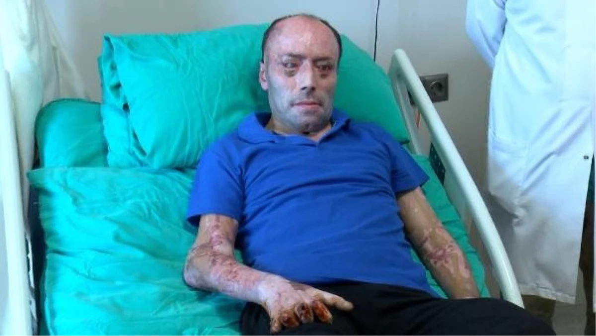 Bartın\'da maden kazasında yaralanan İzzet Ak taburcu oldu