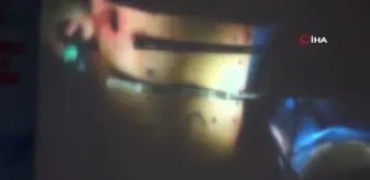 Yurtdışından gelen hekimler, Pektus Kongresi'ne katıldı