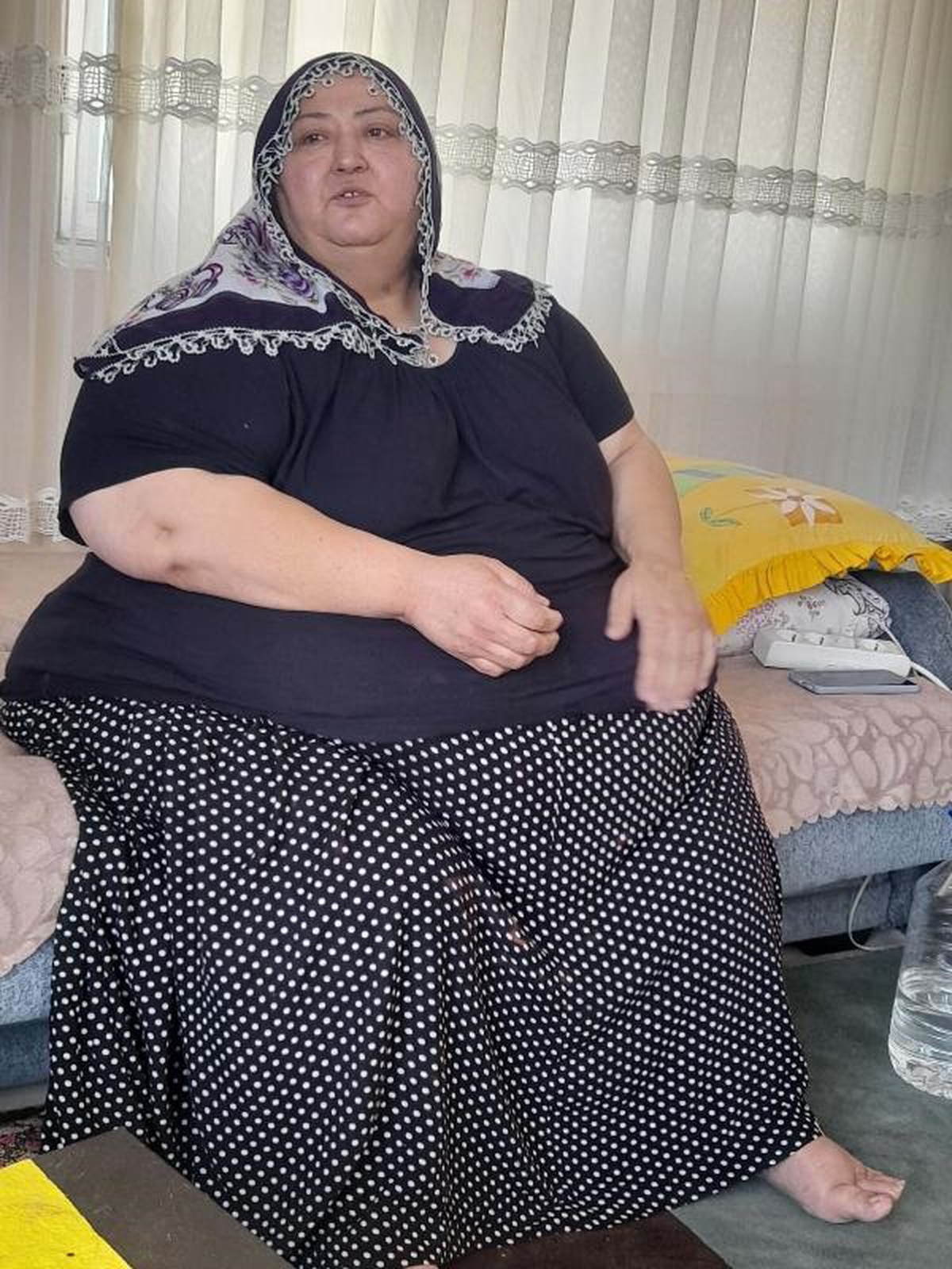 İncirliova\'da Fil Hastalığına Yakalanan Kadın 7 Yıldır Evden Çıkamıyor