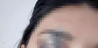 Niğde'de Zorla Evlendirilen 15 Yaşındaki Kız Çocuğu Kurtarıldı