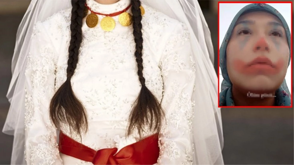 Niğde\'de 15 yaşındaki kız çocuğu zorla evlendirildi, yardım çağrısı sosyal medyada