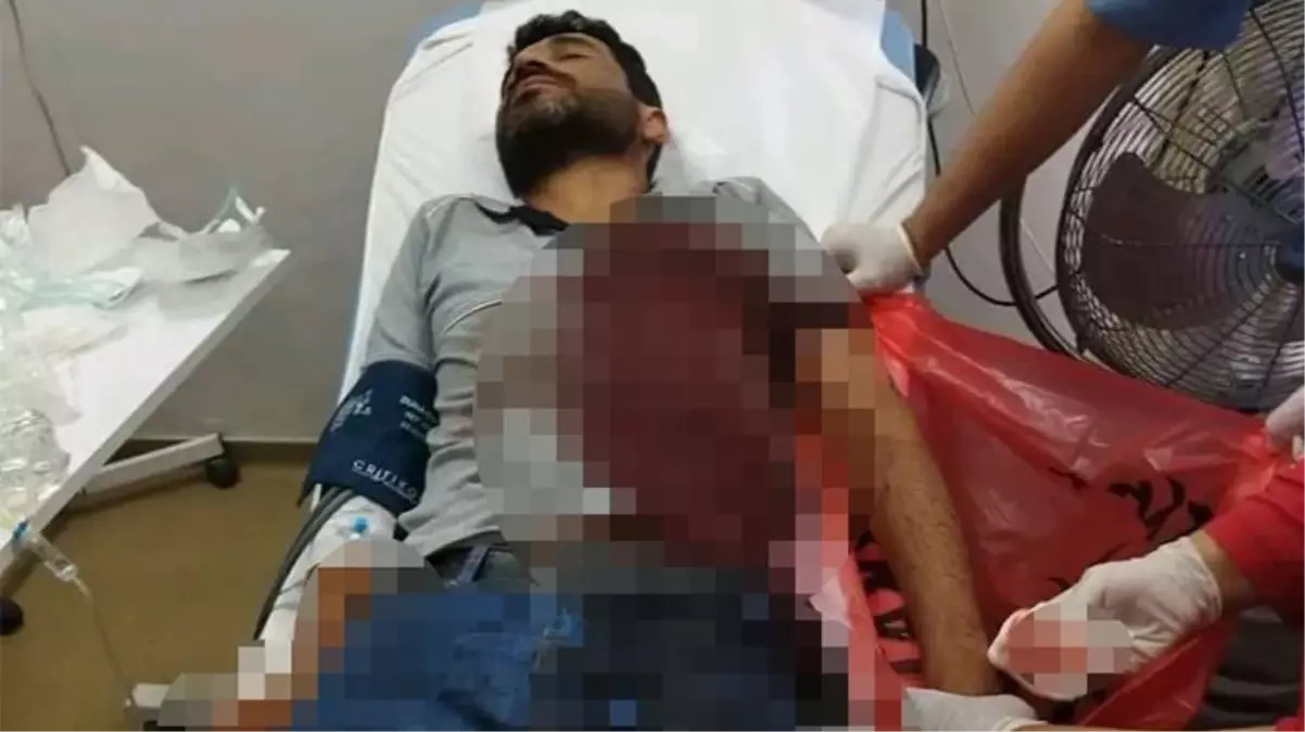 Karamürsel\'de Elektrik Sayacı Okuma Personeli Köpek Saldırısına Uğradı