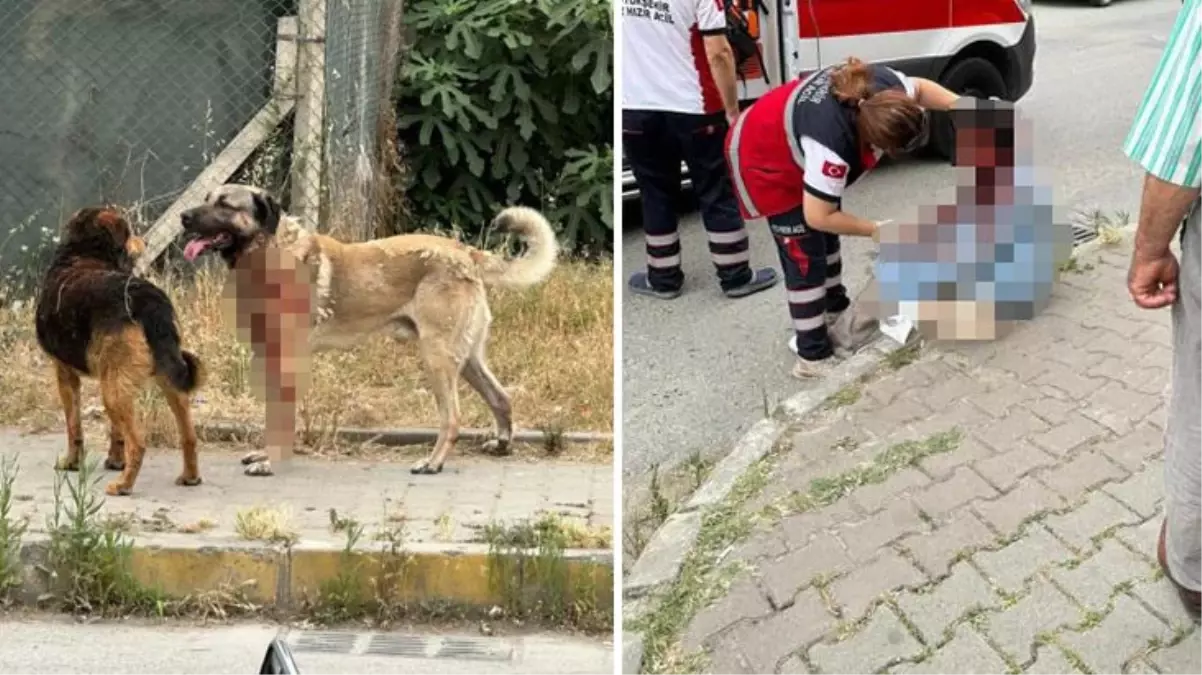 İstanbul\'da köpek saldırısına uğrayan kadın gözünden oldu