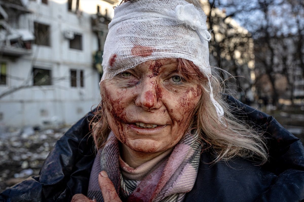 Ukrayna, Rusya-Ukrayna Savaşı\'nda 233 Binden Fazla Rus Askerinin Öldürüldüğünü İddia Ediyor