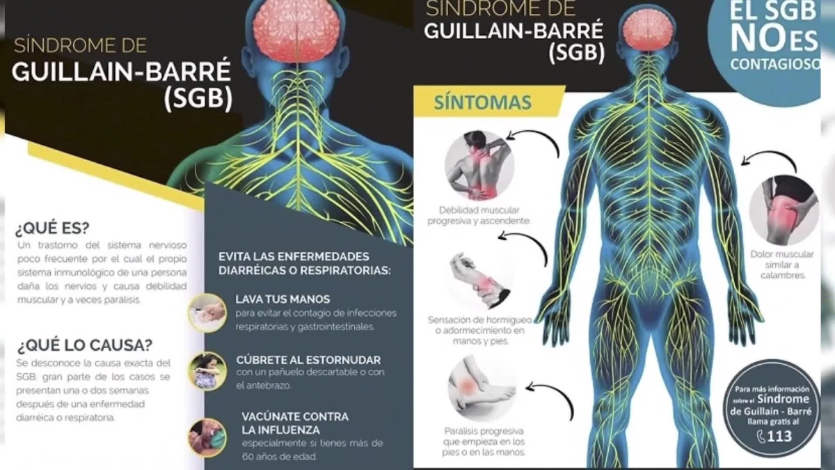 Peru\'da Guillain-Barre sendromu vakalarında artış: 90 günlük sağlık acil durumu ilan edildi