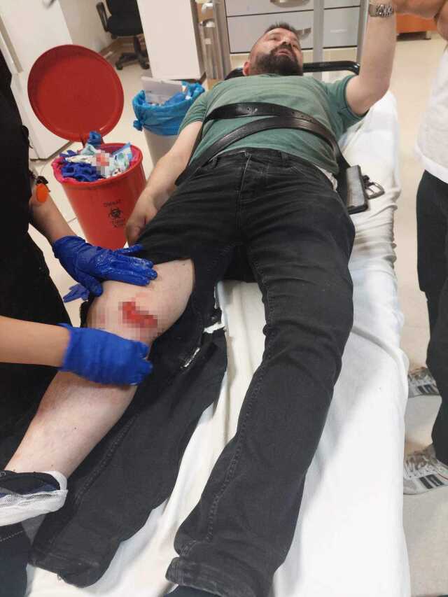Ankara'da başıboş sokak köpeklerinin saldırdığı 2 kişi hastanelik oldu