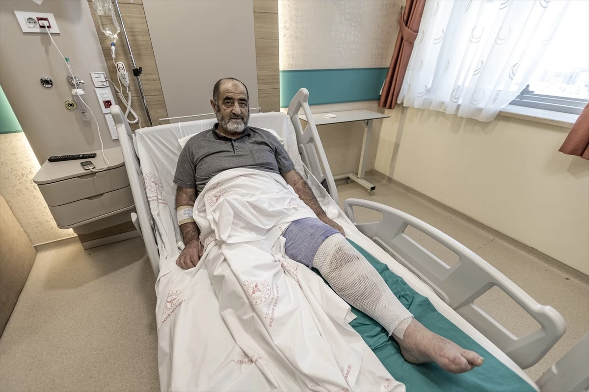 Erzurum\'da İsırgan Otu Tedavisi Yanlışlıkla Yanık Oluşturdu