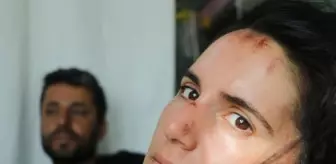 Cilo-Sat Dağları'nda buzulların arasına düşen avcu çifti yaşadıklarını anlattı