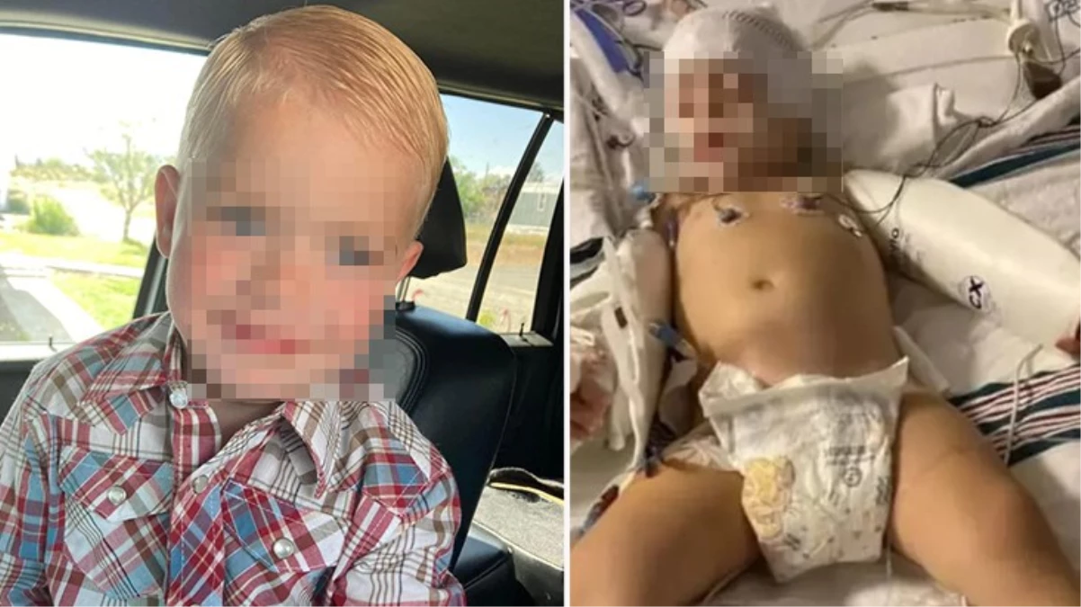 ABD\'de 2 yaşındaki çocuk beyin yiyen amip nedeniyle hayatını kaybetti