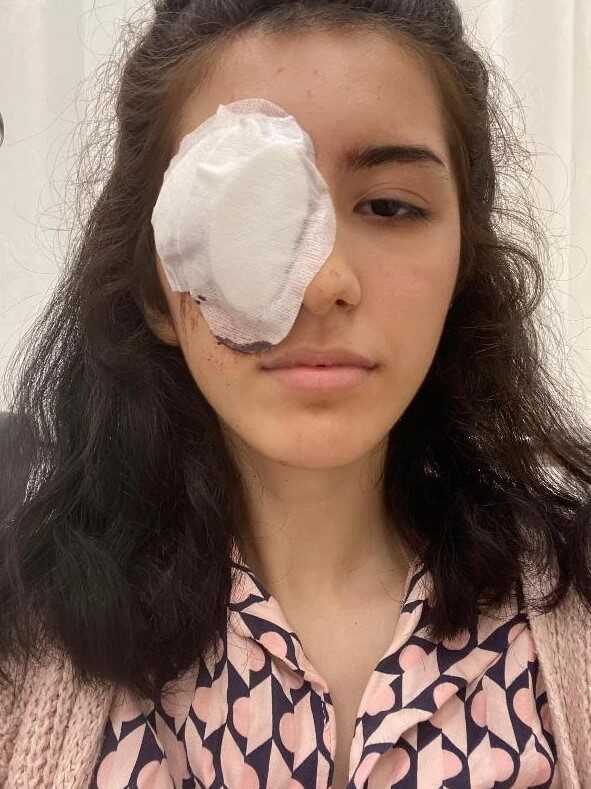 Genç kızın gözünü kaybetmesine neden olan maganda tutuklandı Genç kızın gözünü kaybetmesine neden olan maganda tutuklandı