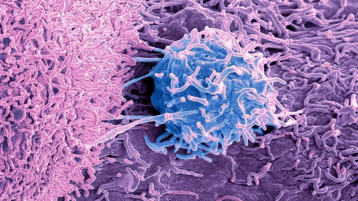 Tümörlerde yaşayan mikroplar, kanserin nedeni ve tedavisiyle ilgili ipuçları barındırabilir