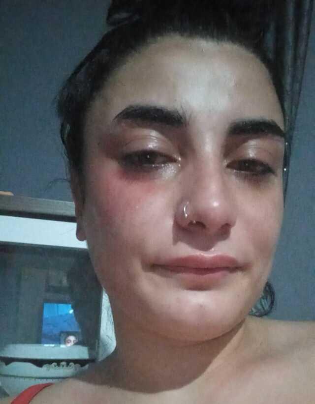 Köpeğiyle markete giren hamile kadına saldırdı, kadın bebeğini kaybetti