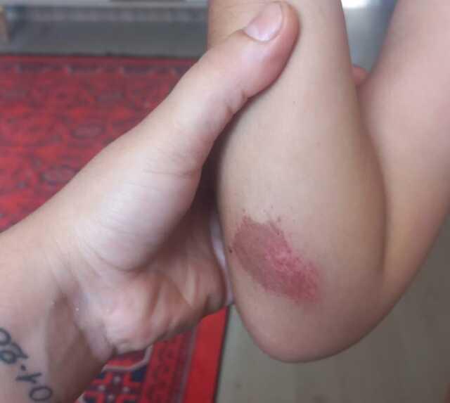 Köpeğiyle markete giren hamile kadına saldırdı, kadın bebeğini kaybetti