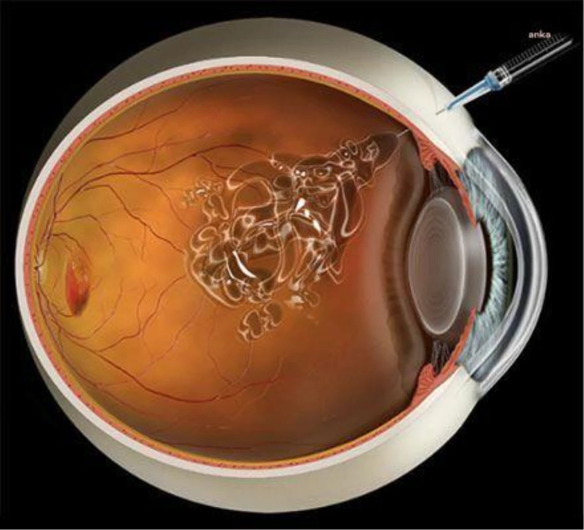 Göz Hastalıkları Uzmanı Prof. Dr. Nur Acar Göçgil: Geç Kalınan Her Süre Kalıcı Hasar Oluşma Riskini Artırıyor