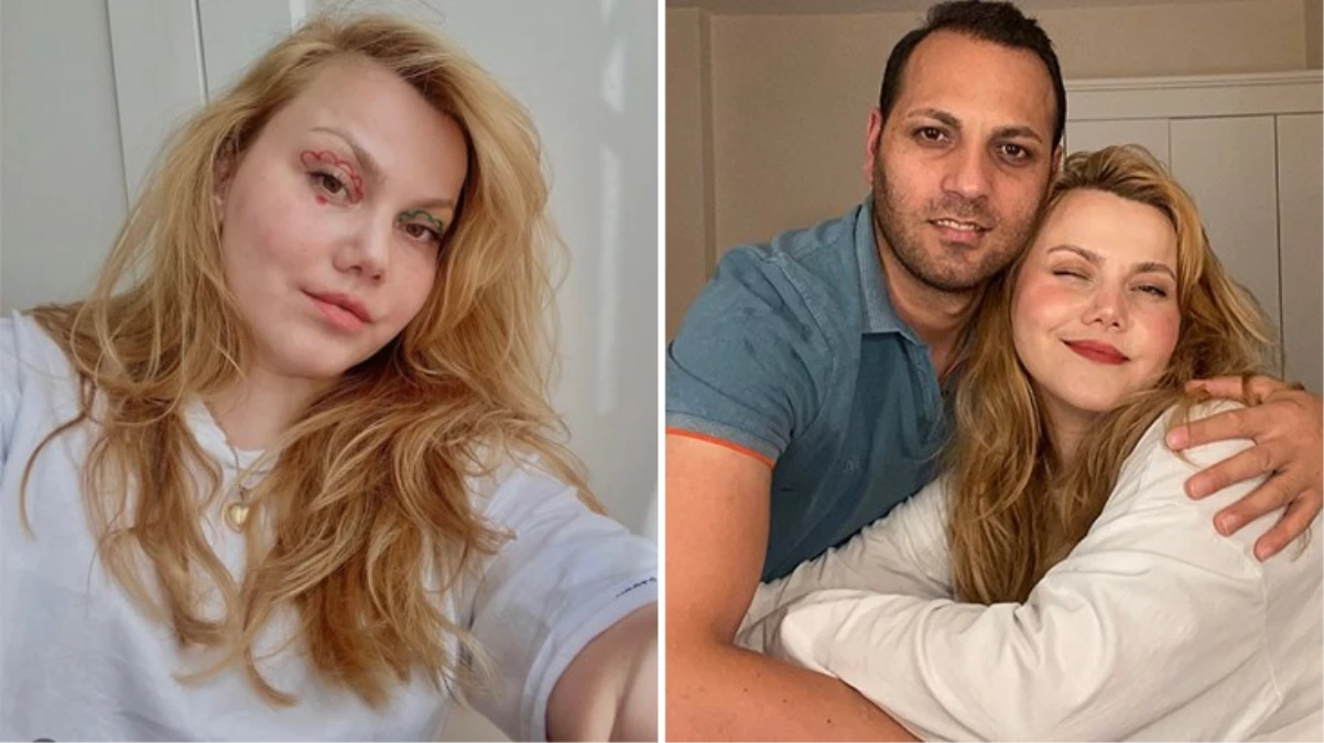 Ünlü Youtuber Merve Yıldırım, Kocası Tarafından Bıçaklı Saldırıya Uğradı