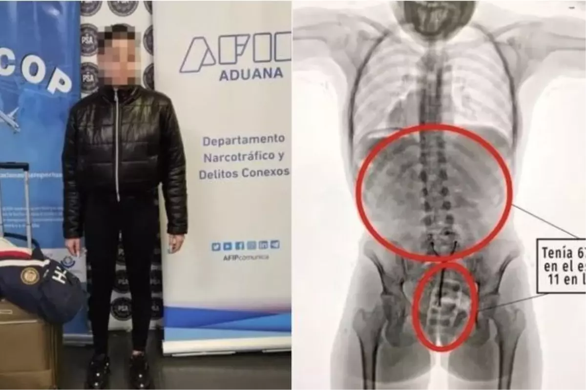 Arjantin Havalimanında 20 Yaşındaki Kadın Vajina ve Midesine Sakladığı Kokainle Yakalandı