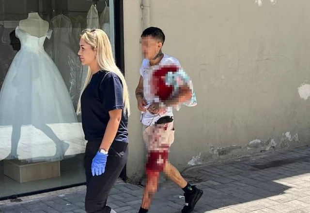 Kıskançlık krizine giren eski sevgili, evdeki tamirciyi bıçakladı Kıskançlık krizine giren eski sevgili, evdeki tamirciyi bıçakladı