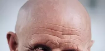 Batman'da down sendromlu Habip Başkan hayatını kaybetti