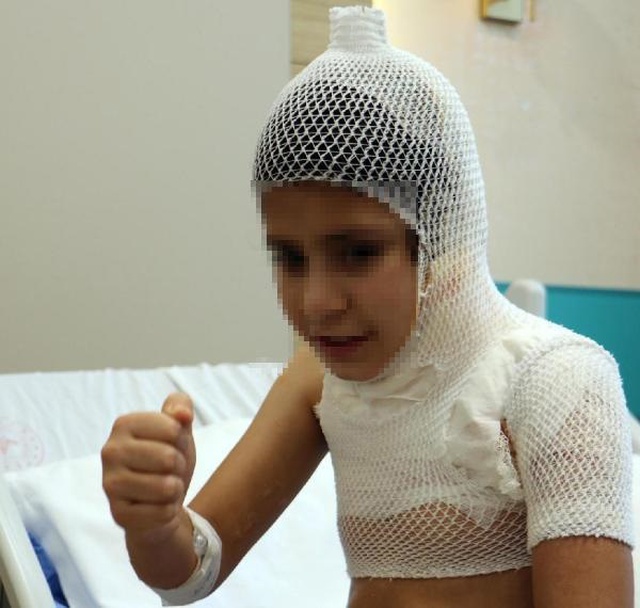 Sosyal medya trendini deneyen çocuk ağır yaralandı Sosyal medya trendini deneyen çocuk ağır yaralandı