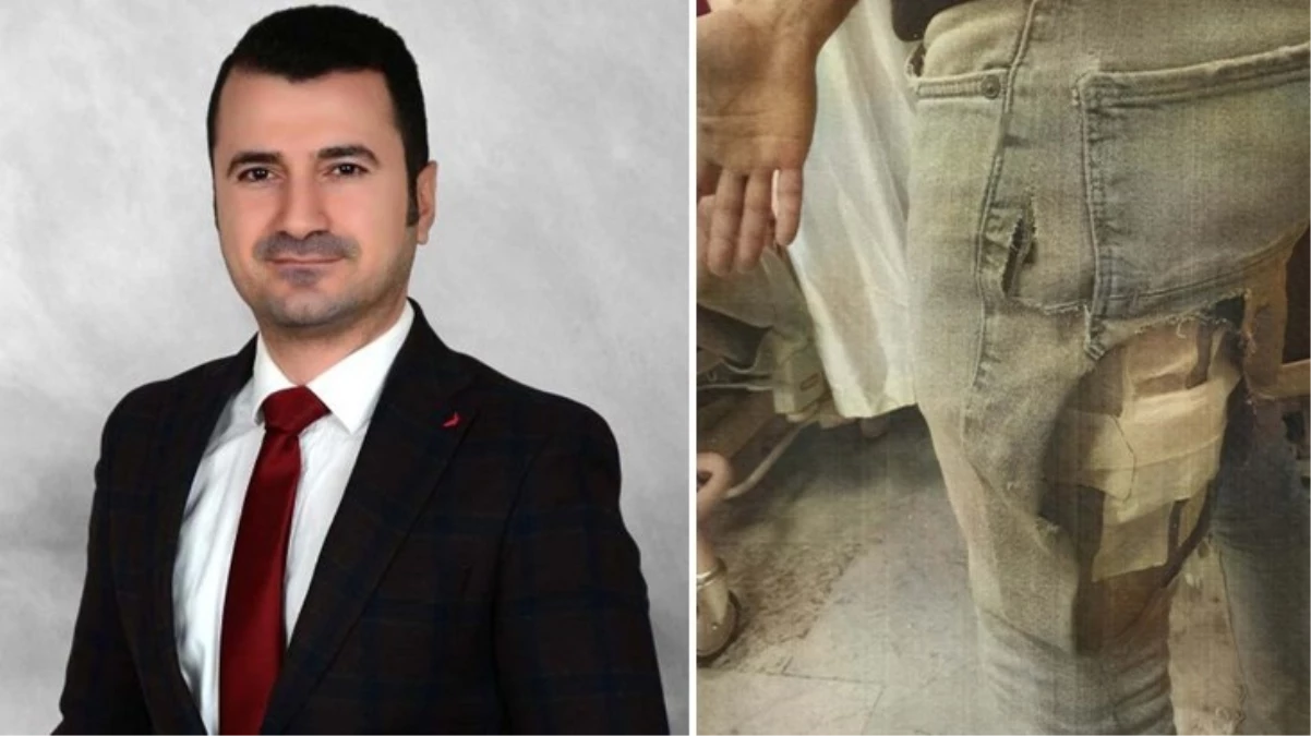 Köpeklerin saldırısında yaralanan avukat, İzmir Büyükşehir Belediyesi\'ne açtığı tazminat davasını kazandı
