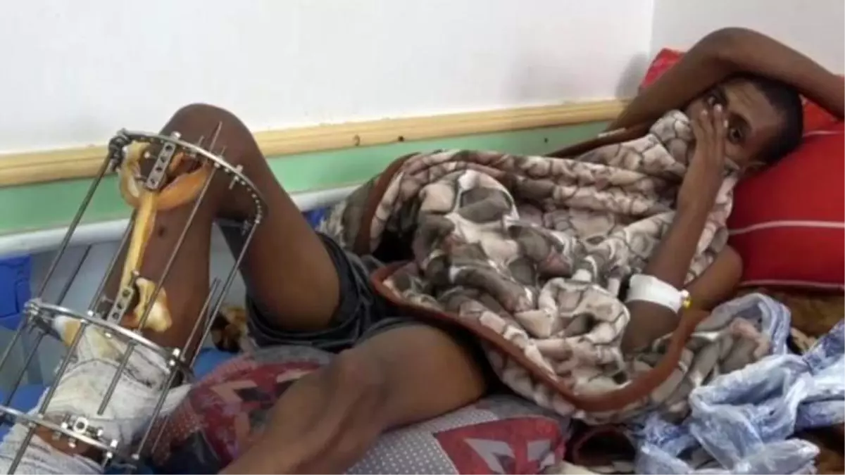 Suudi Arabistan, Yemen sınırında yüzlerce göçmeni öldürmekle suçlanıyor