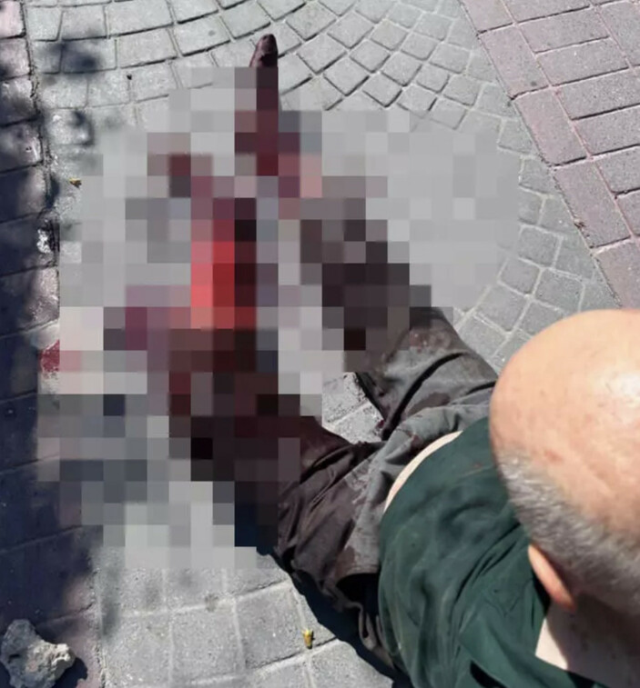 Bakırköy'de başıboş bırakılan pitbull köpeği vatandaşlara saldırdı! Yaşlı adam kanlar içerisinde kaldı