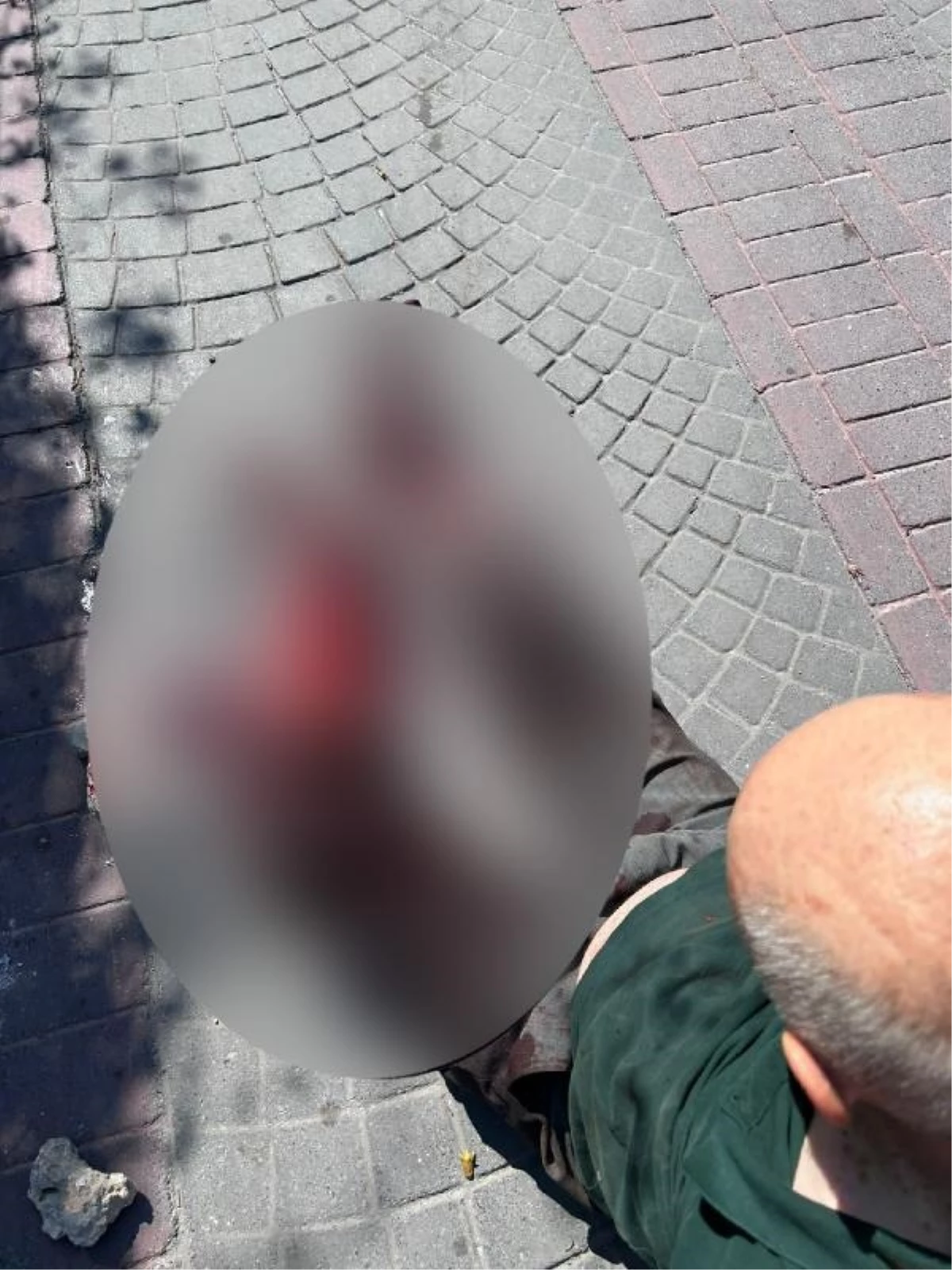 Pitbull Cinsi Köpek Tarafından Saldırıya Uğrayan Kişi Yaralandı