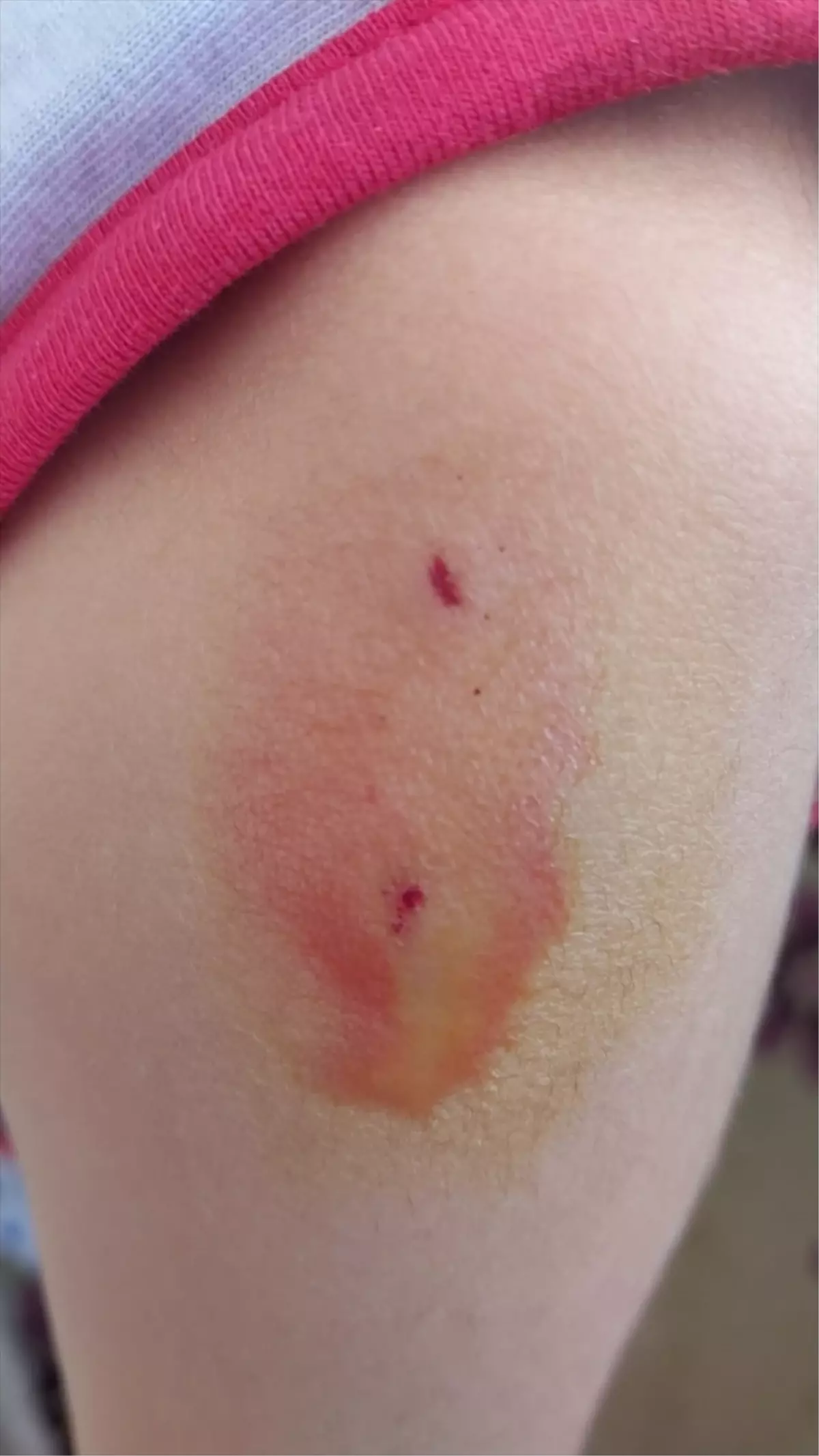 Kastamonu\'da sahipsiz köpeklerin saldırdığı çocuğu babası kurtardı