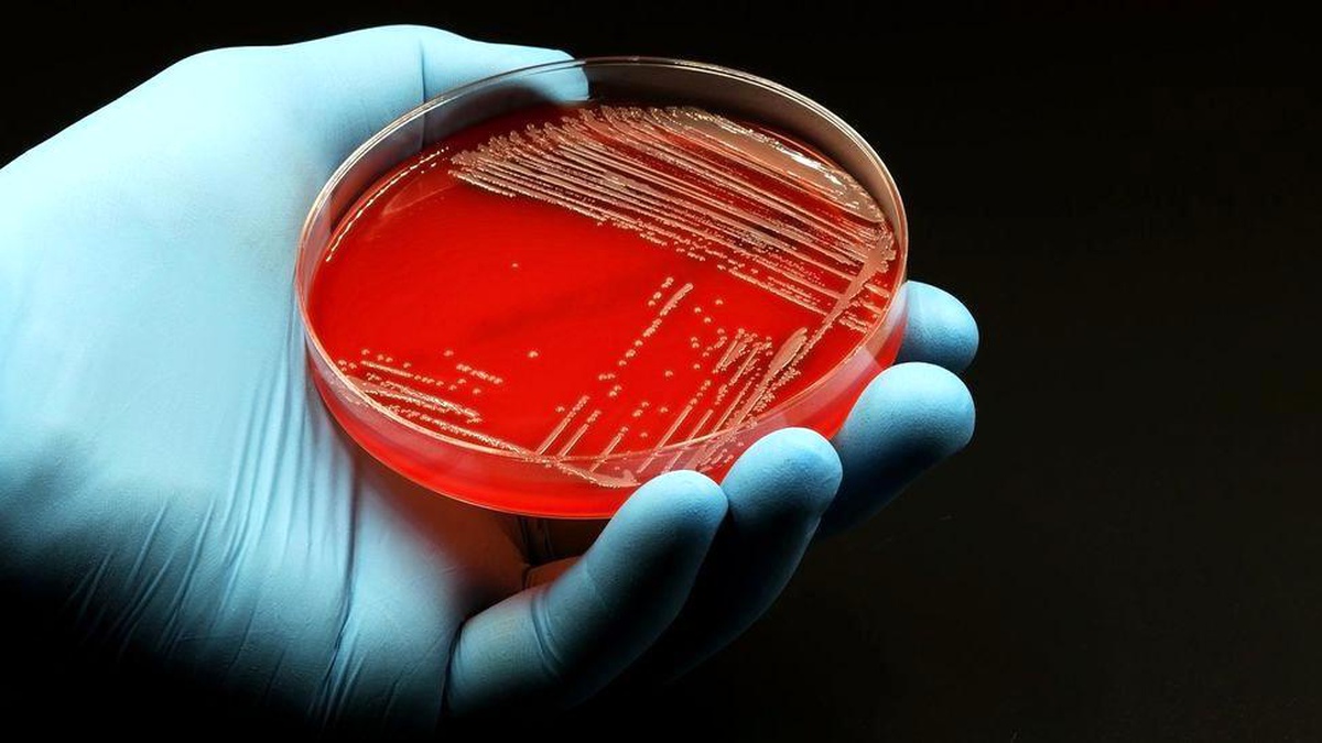 Antibiyotikler bağırsaktaki faydalı bakterileri yok ediyor mu?