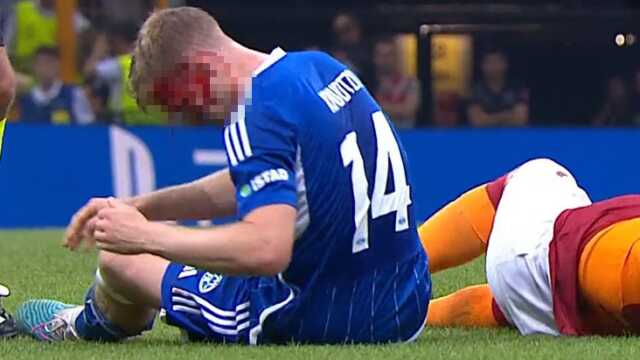 Yürekler ağza geldi! Icardi'yi durdurmaya çalışan iki oyuncu çarpıştı birinin kafası yarıldı