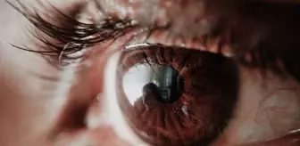 Astigmat nedir, neden olur? Astigmat nasıl görür?