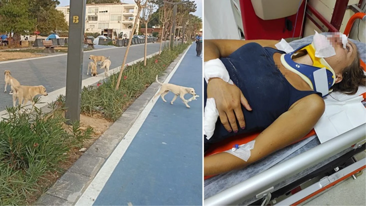 Başıboş sokak köpeklerinin saldırdığı kadın ve kızı, scooterdan düştü
