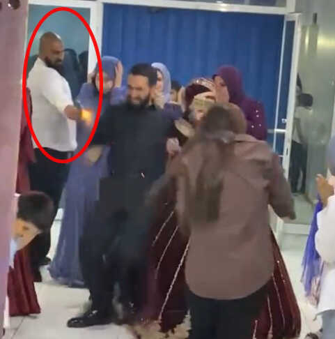 Düğününde 8 kurşunla yaralanan damattan ilk kare! Sağlık durumu iyiye gidiyor Düğününde 8 kurşunla yaralanan damattan ilk kare! Sağlık durumu iyiye gidiyor