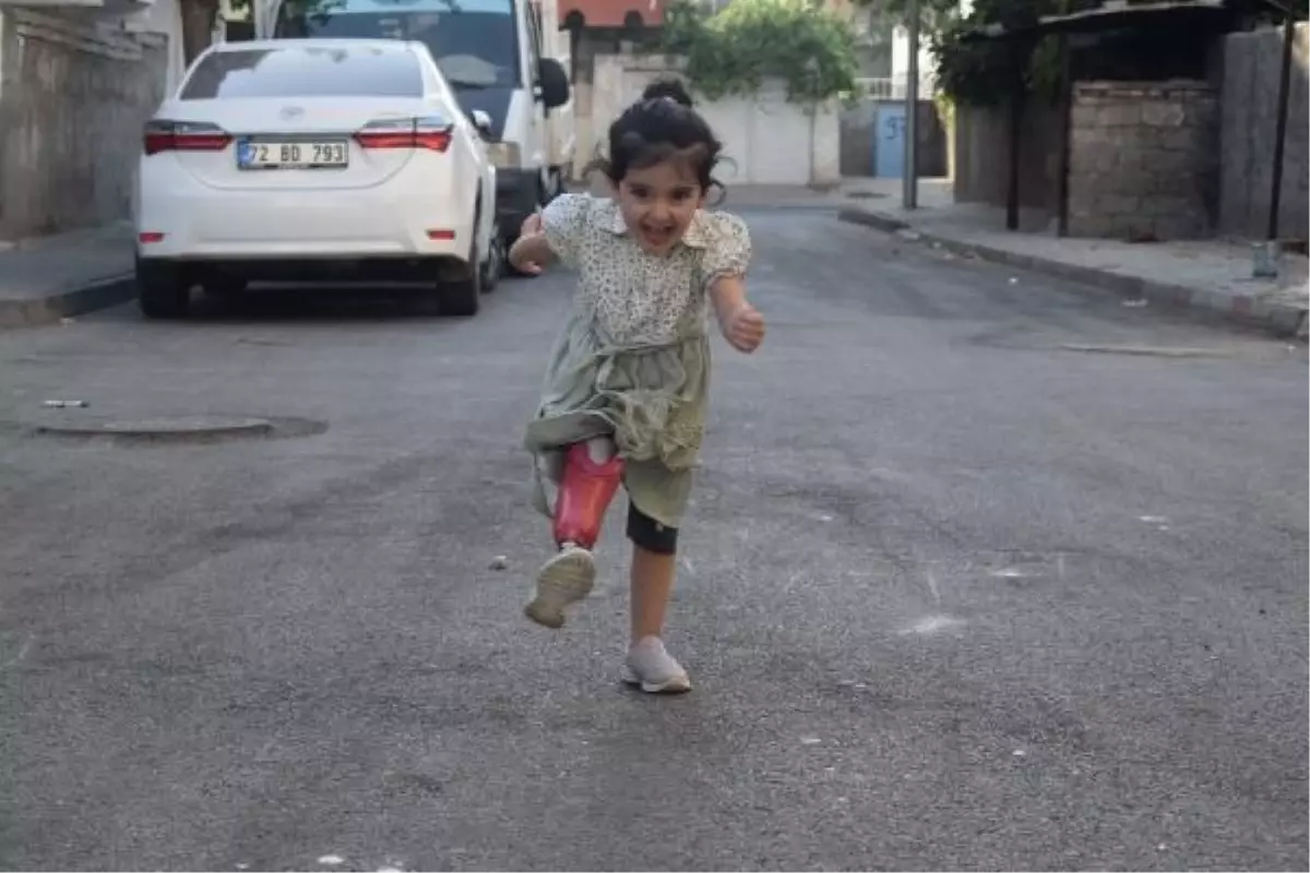 Engelli kardeşler protez bacaklarla yürümeye başladı