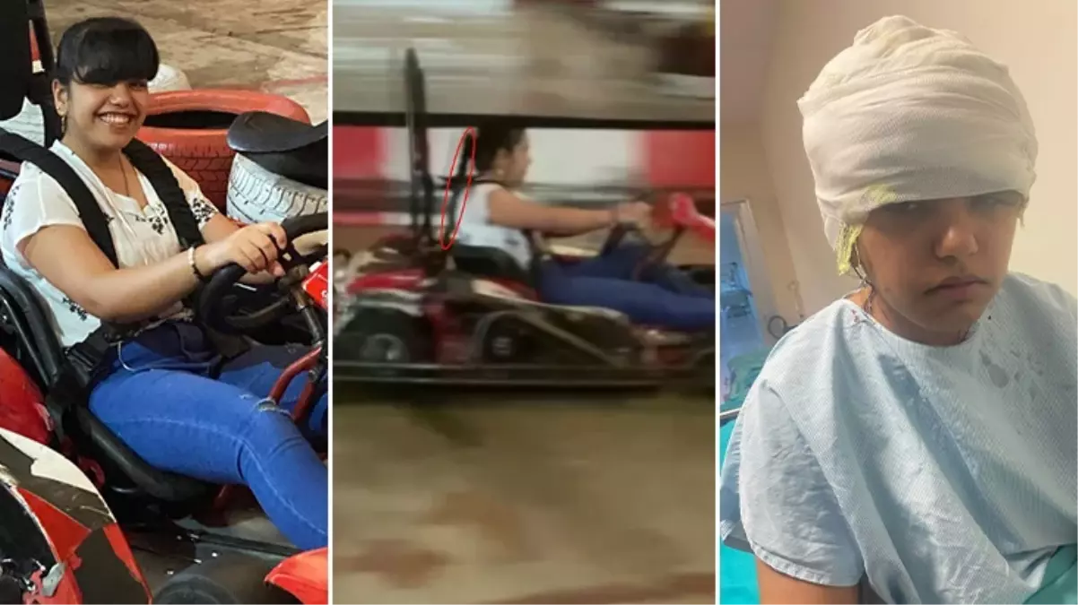 Go-kart\'ta saçı tekerleğe dolanan genç kızın kafa derisi yerine dikildi