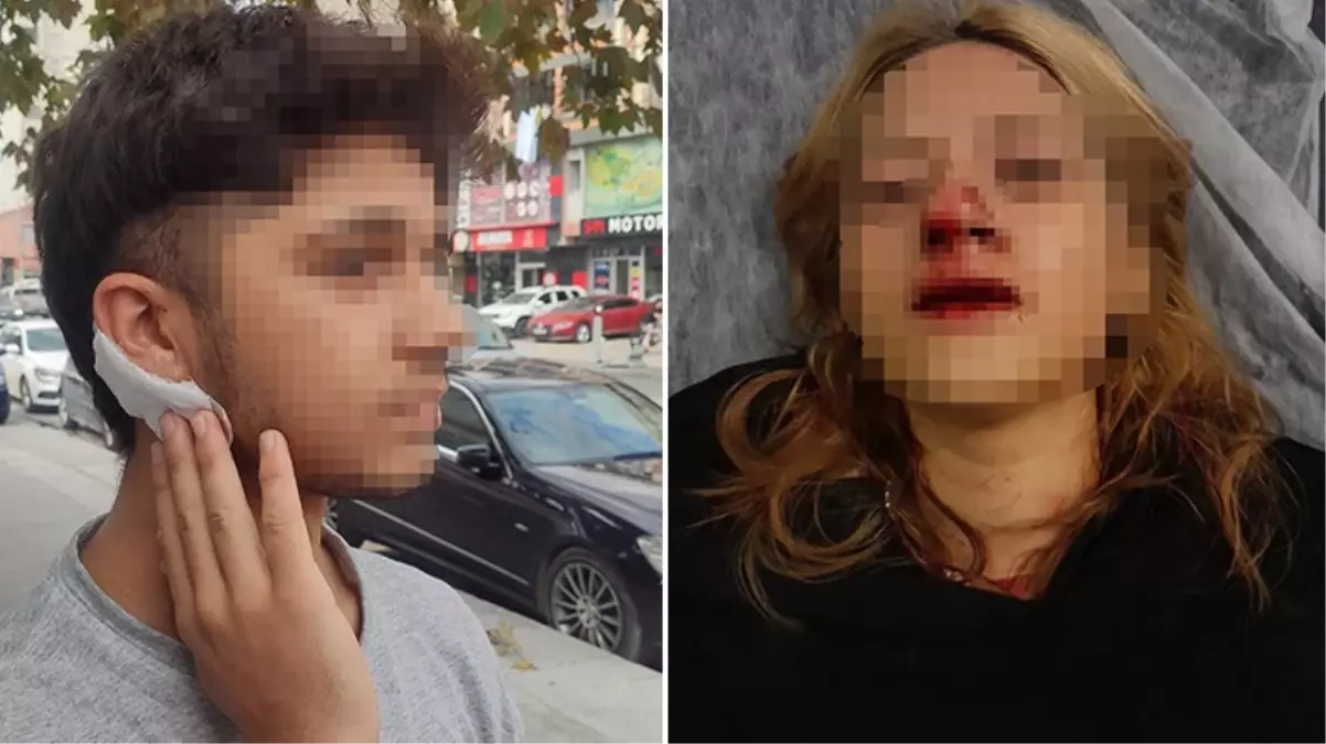 Parkta kaldırım taşıyla saldırdıkları kızın dişleri kırıldı, arkadaşının kulağı kesildi