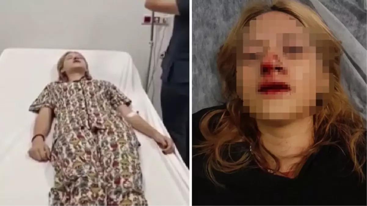 Sultangazi\'de genç kıza kaldırım taşıyla saldıran 2 şüpheli tutuklandı