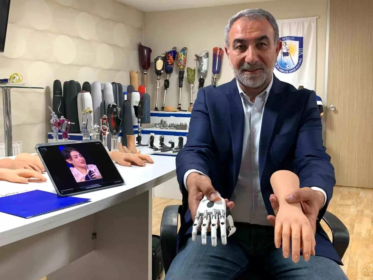 Yarışmadan 1 milyon lira kazanan Rabia\'nın protezini iş adamı karşılayacak