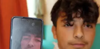 Yıldırım düşen gençler yaralandı, zincir kolye parçalandı