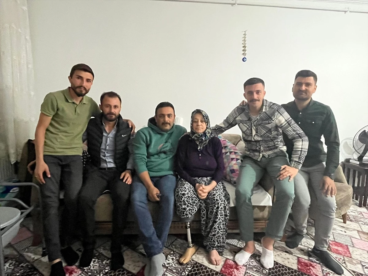 Amasya\'da şeker hastası kadına protez bacak yardımı