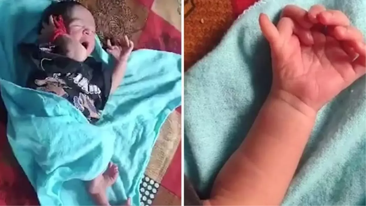 Hindistan\'da 26 parmakla dünyaya gelen bebek tanrıça olarak görülüyor
